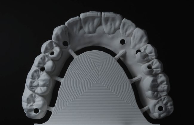protesis dentales zirconio